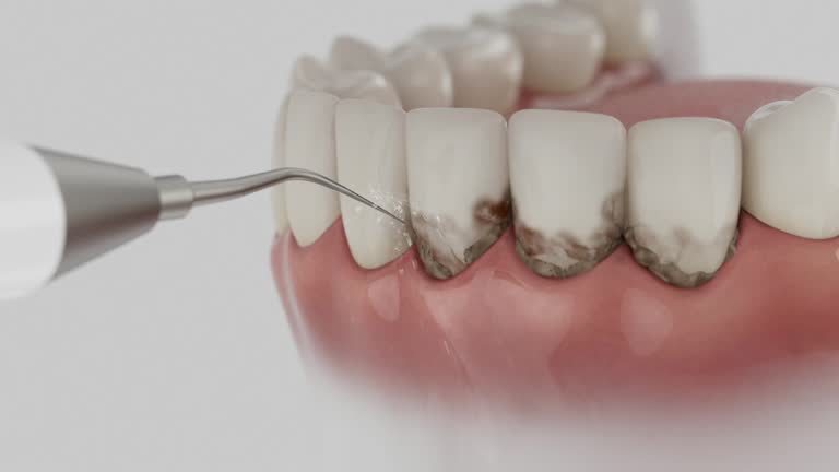 Reliable Dental Implants contractor in Parksdale, CA by Smile Center Dentistry